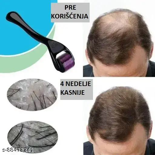 Derma Roller™ Roler Za Negu Tela Derma Roller™ Roler Za Negu Tela - Image 5